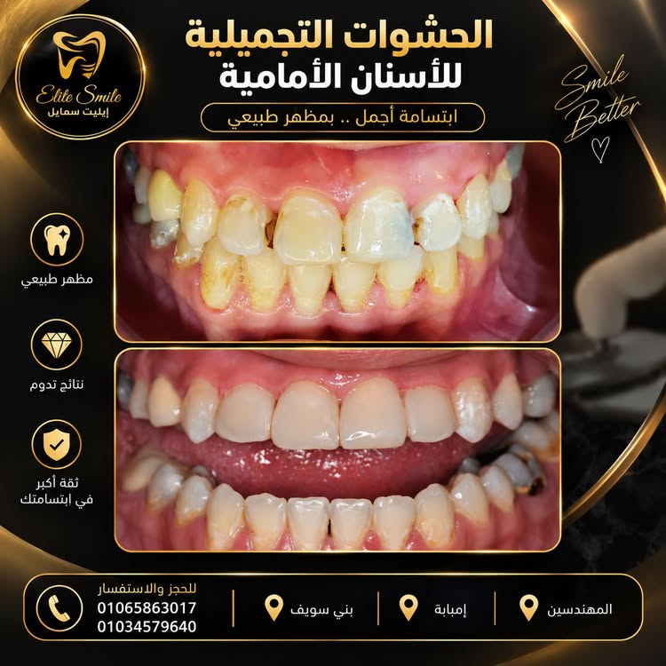 حالة أسنان قبل العلاج